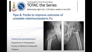 TOTAC2021 Ep2 Part 410 Tips amp Tricks for unstable intertrochanteric Fx By DrTheerachai CMU [upl. by Dynah]