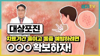 대상포진 치료 기간 줄이고 통증 예방하는 법 [upl. by Agemo269]