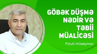 Göbək düşmə nədir Göbək düşmənin təbii müalicəsi  Fizuli Hüseynov [upl. by Atteloj]