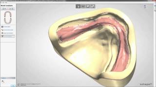 Dental System 2013  Full Dentures [upl. by Johnna]