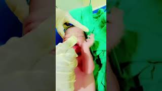 Newborn suctioning videotrendingshortviral [upl. by Aelahs802]