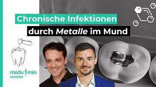 Chronische Infektionen durch Metalle im Mundraum 🦷 Dr med dent Holger Scholz [upl. by Bortz]