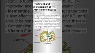 Treatment and management of Alzheimer’s disease [upl. by Lashar]