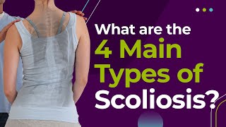 What Are The 4 Main Types of Scoliosis [upl. by Potter857]