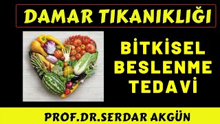 Damar Tıkanıklığı Bitkisel Tedavi ile Açılır mı Bitkiler Damar Tıkanıklığı Tedavisi [upl. by Camella]