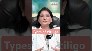 Types of Vitiligo  Vitiligo skin disease  Vitiligo Treatment in Ludhiana [upl. by Kavanaugh697]