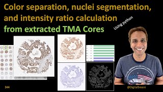 344 Color separation and nuclei segmentation in cores extracted from TMA [upl. by Clint]