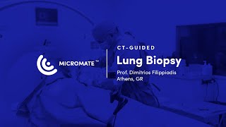 Micromate™  CTguided RoboticAssisted Lung Biopsy Prof Dimitrios Filippiadis [upl. by Lon]