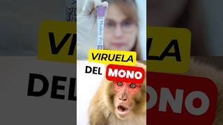 ¿EXISTE algún Tratamiento Eficaz para la VIRUELA del MONO 🙊 💉 virueladelmono mpox [upl. by Sapienza]