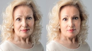 How to Get Rid of Forehead Wrinkles Fast  Remove Forehead Wrinkles [upl. by Rednav]