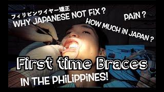 WOW PHILIPPINS DENTIST very different BRACES orthodontics [upl. by Irap]