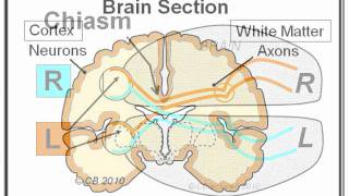 Migraine 3 Mechanism [upl. by Mahmoud]