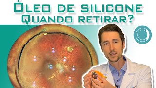 Quanto tempo o óleo de silicone pode ficar dentro do olho Pós cirurgia de descolamento de retina [upl. by Essyla604]