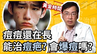 痘疤越早治療越好？痘痘還在長，可以治痘疤？會爆痘嗎？皮膚科林政賢醫師來告訴你把握痘疤治療黃金時間！ [upl. by Atilemrac]