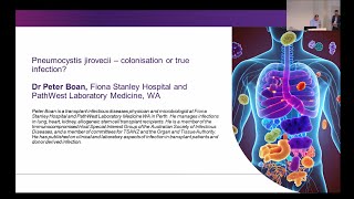 Pneumocystis jirovecii – colonisation or true infection Dr Peter Boan [upl. by Jed468]