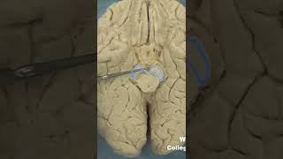 Interpeduncular fossa neuroanatomy brainstembrainWCUCOM Neuroscience [upl. by Suriaj156]