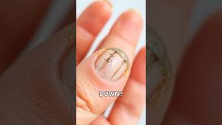 💅🦷 Weak Nails Heres How to Strengthen Them 💪🖤BrittleNails NailCare HealthyNails [upl. by Anneuq]