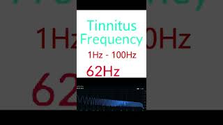 Pulsatile Tinnitus Frequencies 1Hz 100Hz [upl. by Ennairek685]