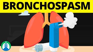 Bronchospasm Medical Definition  Quick Explainer Video [upl. by Constantino805]