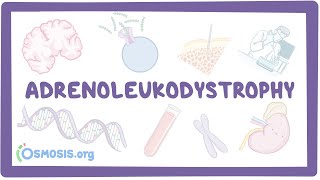 Adrenoleukodystrophy  causes symptoms diagnosis treatment pathology [upl. by Shanks360]