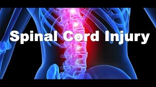 What is a spinal cord injury [upl. by Anoyk]