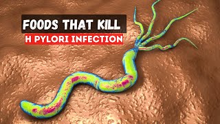 5 Foods That Kill H Pylori Infection [upl. by Kathie]