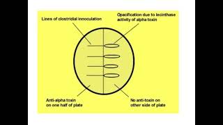 Lecithinase or Naglers Test [upl. by Enyalaj]