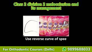 Basic Intro into MIPS  li add sub mul div [upl. by Rovert]