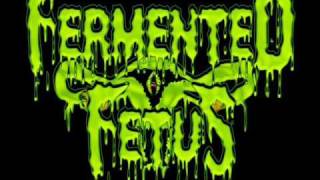 Fermented Fetus  Gangrene Scrotum [upl. by Cuthbertson376]