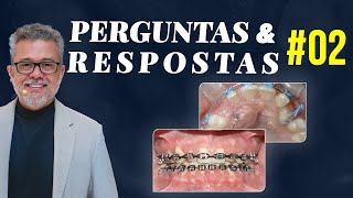 PerguntasampRespostas2 [upl. by Nachison299]