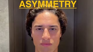 How to fix asymmetry looksmaxxing jawline asymmetry [upl. by Ganiats]