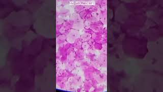 Squamous epithelial cells microscope slide🔬shortvideo youtube [upl. by Banwell15]