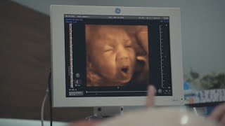 Is your baby gonna love or hate Marmite  Marmite Baby Scan Advert [upl. by Denie241]