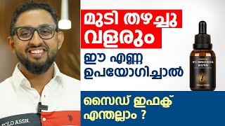 മുടി തഴച്ചു വളരും ഈ എണ്ണ ഉപയോഗിച്ചാൽ മതി  Minoxidil Side Effects  Dr varun Nambiar [upl. by Aicsile]