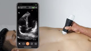 Cardiac Apical 4 Chamber View  Ultrasound Scanning Technique [upl. by Onilegna]