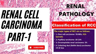 RENAL CELL CARCINOMA PART1  RENAL PATHOLOGY  NEPAL MEDICAL COLLEGE  RD ANISH SAH [upl. by Nyrehtac]