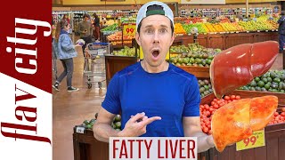 Top 10 Foods For Reversing FATTY LIVER DISEASEAnd What To Avoid [upl. by Narot965]