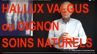 Vidéo Comment soigner le hallux valgus ou oignon  Soins naturels par Guy Roulier [upl. by Glyn]