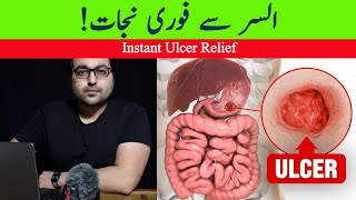 Dr ZeeThe FASTEST Way to Heal an Ulcer  डॉक्टर ज़ी [upl. by Kaiulani]