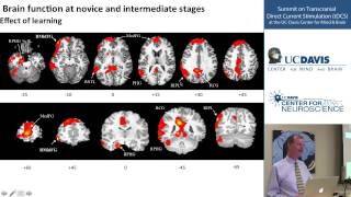 TDCS for Cognitive Enhancement [upl. by Malamud]