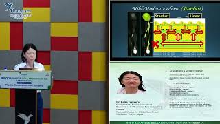 Dr Reiko Tsukuura talk on Technical advances in Lymphedema surgery  CME program  31082024 [upl. by Aiket84]