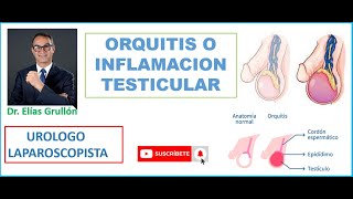 Inflamación del Testículo ORQUITIS [upl. by Unam]