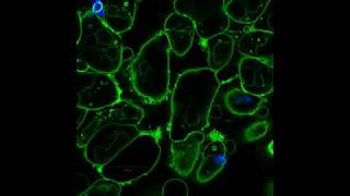 Endocytic Markers Associated with the Internalization and Processing of Aspergillus fumigatus [upl. by Ruprecht]