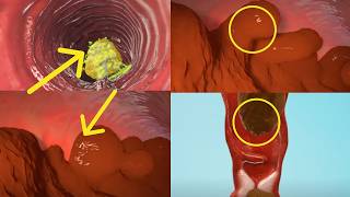 ¿Cómo convierte el cuerpo la comida en heces Sistema digestivo humano Animación [upl. by Yerd925]