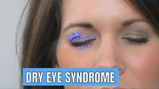 Signs and symptoms of Dry eye syndrome and treatment [upl. by Anilra341]