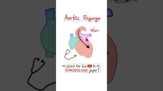 Aortic Regurgitation AR  Valvular Heart Disease VHD…biology science cardiology anatomy [upl. by Ahseid]