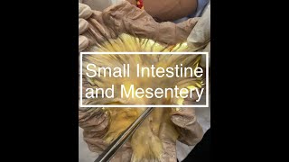 Small Intestine and Mesentery Dissection [upl. by Haugen]