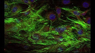 Flexible Nanoparticles Reach Sterically Obscured Endothelial Targets [upl. by Donadee]