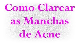 Como Clarear as Manchas de Acne [upl. by Vitus744]