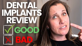 What I Didnt Like About My Dental Implants  4 Years Later [upl. by Katha226]